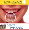 Dental Implants Cost