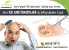 Hair Transplant in Chennai