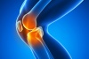 Best Doctor for Knee Arthritis