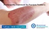 Best Homeopathy Treatment For Psoriasis 