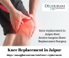 Knee Replacement