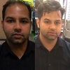 Hair Patch Treatment in mumbai